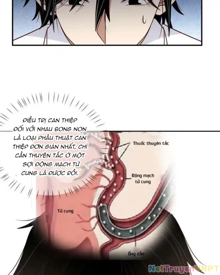Livestream Phẫu Thuật Chapter 42 - Next Chapter 43