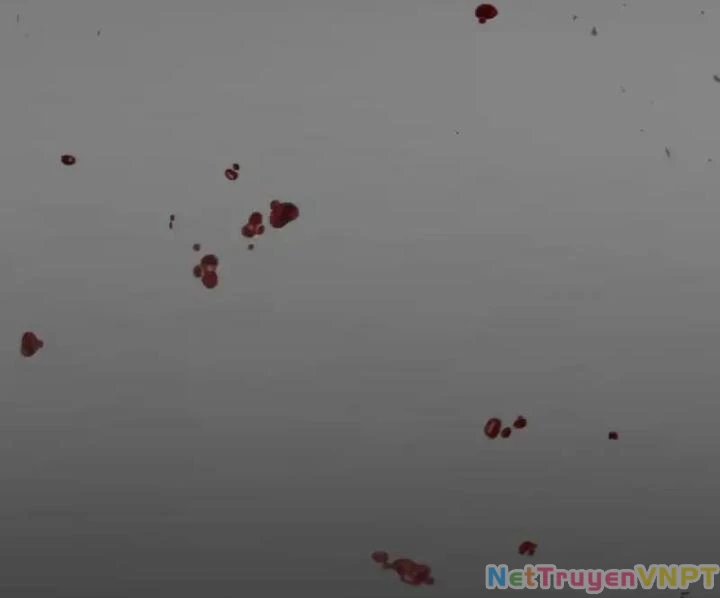 Livestream Phẫu Thuật Chapter 49 - Next Chapter 50